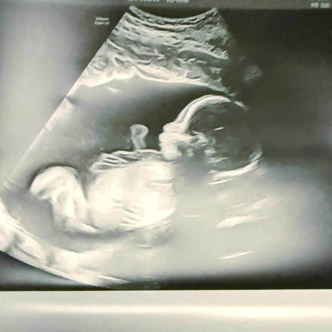 Photo shared by Bailee for their Babylist baby registry.