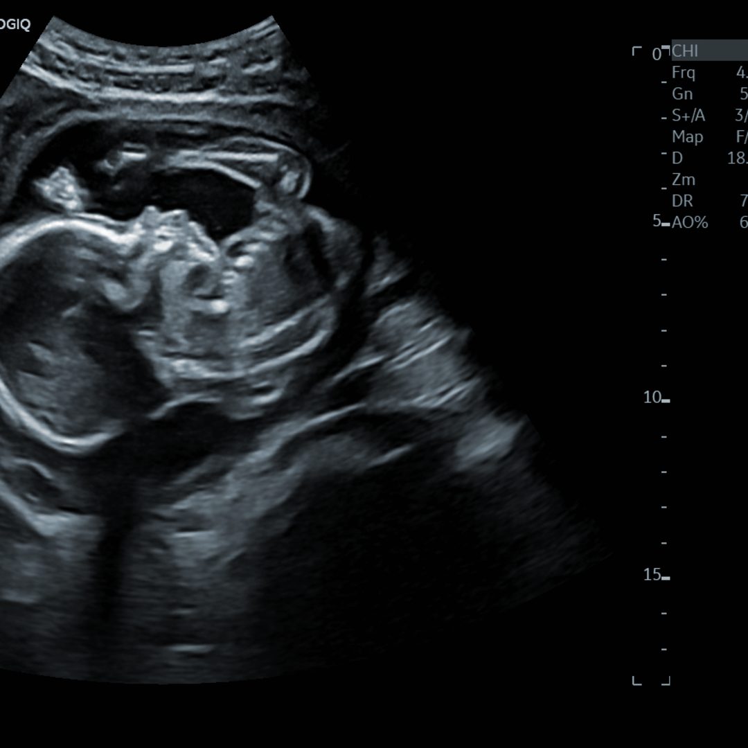 Photo shared by Aalena for their Babylist baby registry.