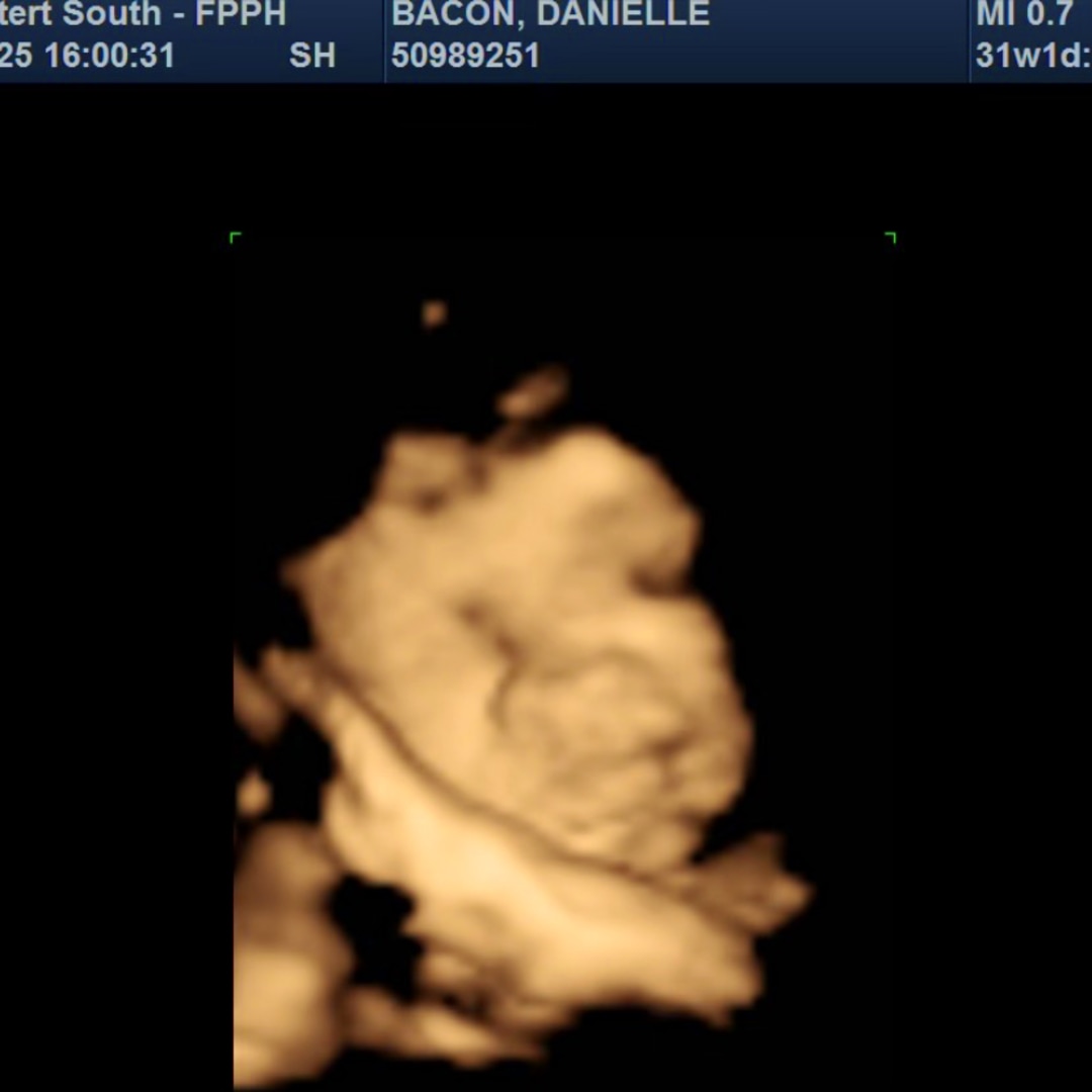 Photo shared by Danielle for their Babylist baby registry.