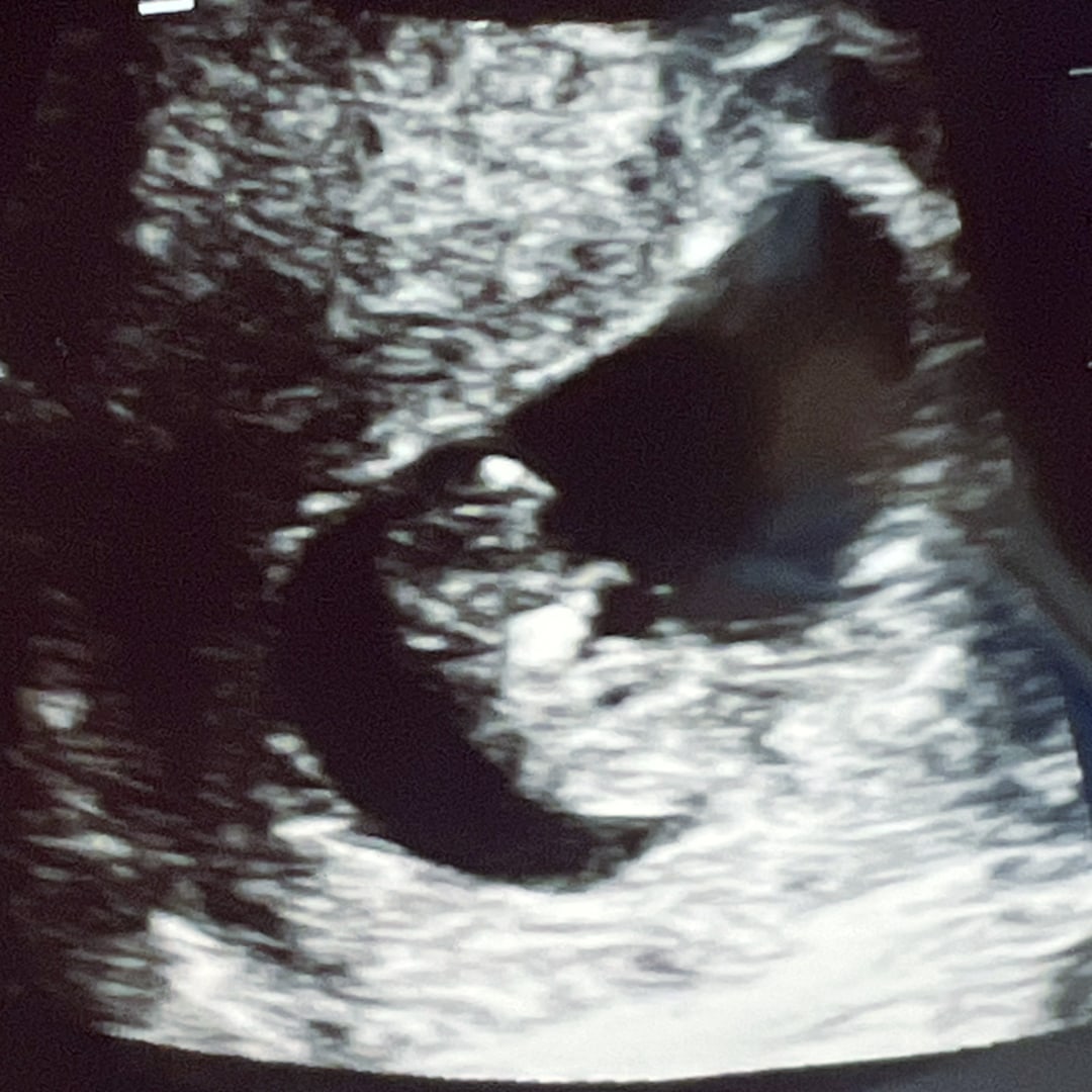 Photo shared by Tiffany for their Babylist baby registry.