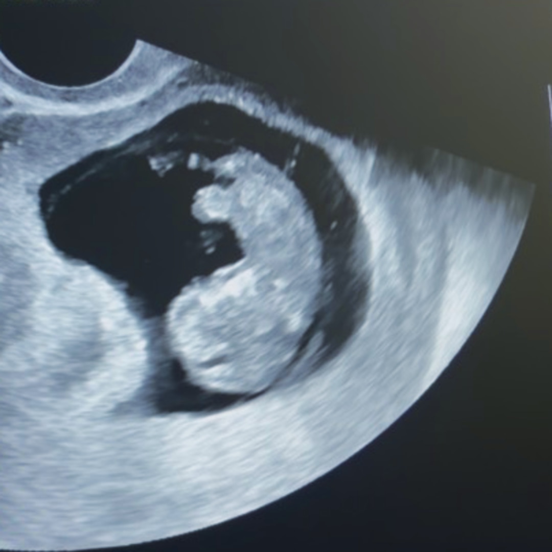 Photo shared by ViAnna for their Babylist baby registry.
