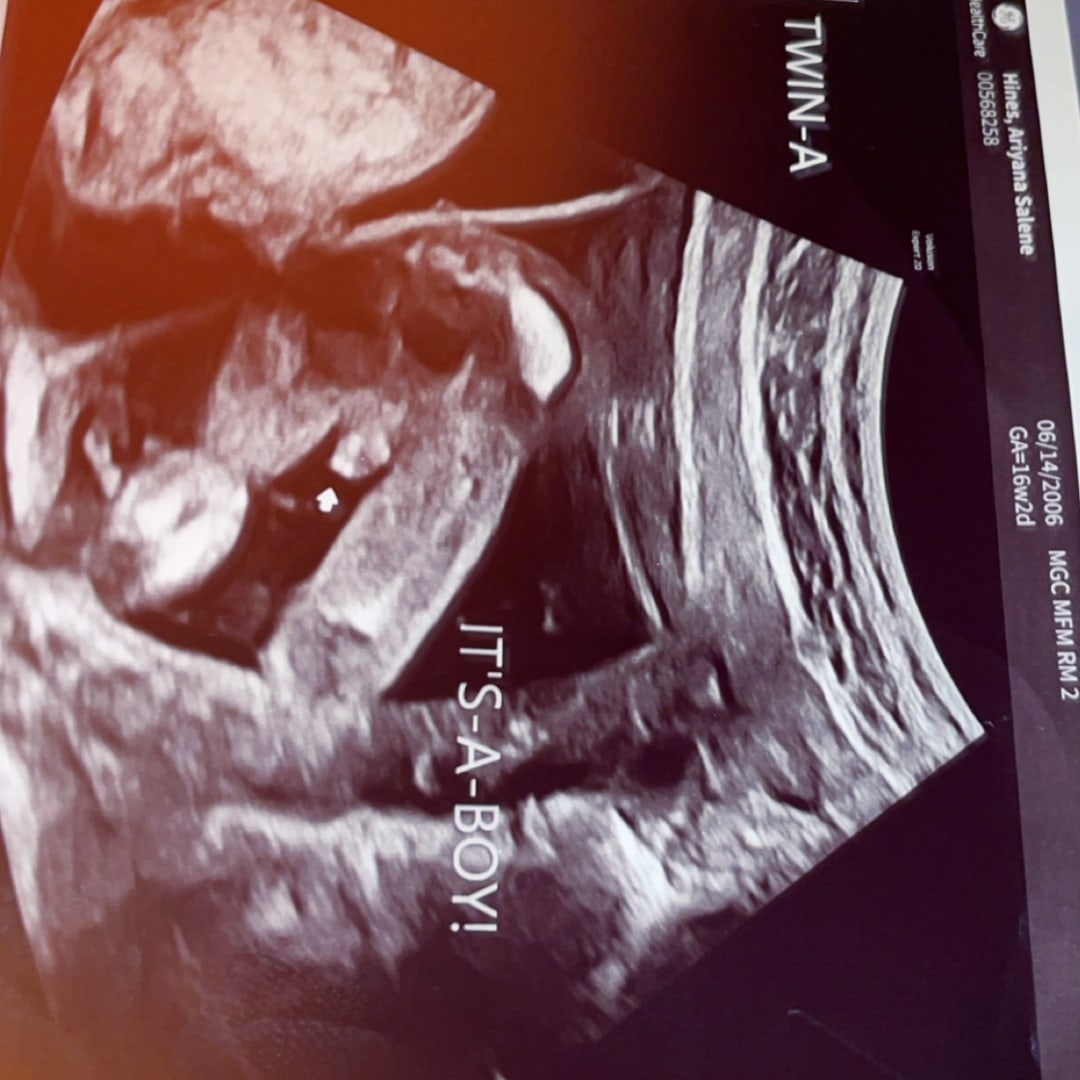 Photo shared by Ariyana for their Babylist baby registry.