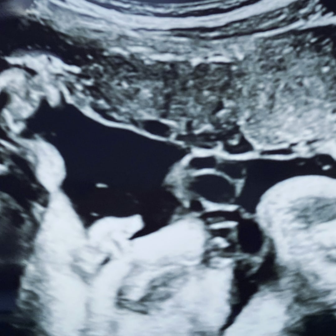 Photo shared by Cece for their Babylist baby registry.