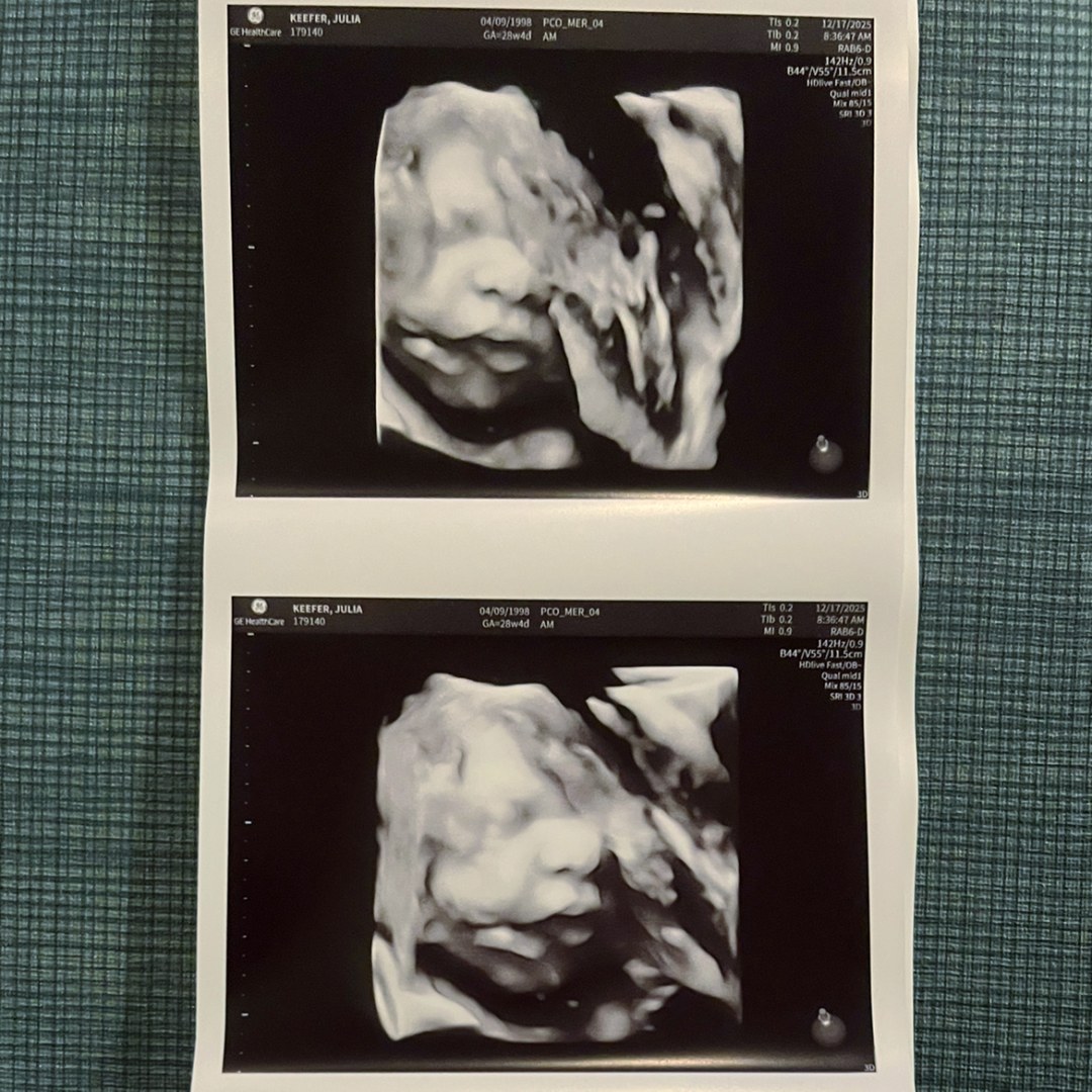 Photo shared by Julia for their Babylist baby registry.