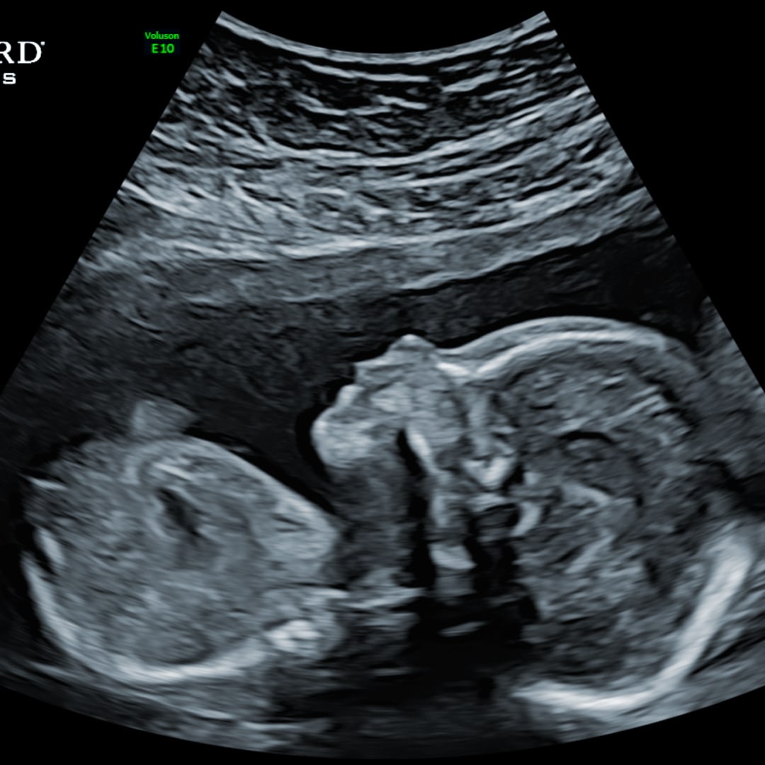 Photo shared by Alicia for their Babylist baby registry.