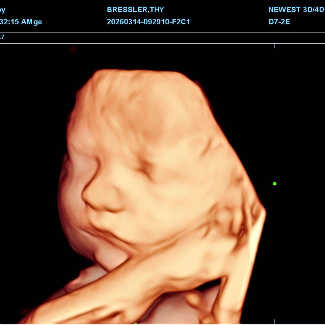 Photo shared by Thy for their Babylist baby registry.