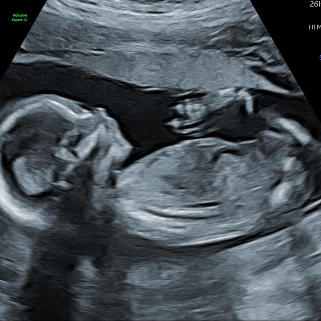 Photo shared by Shayne for their Babylist baby registry.