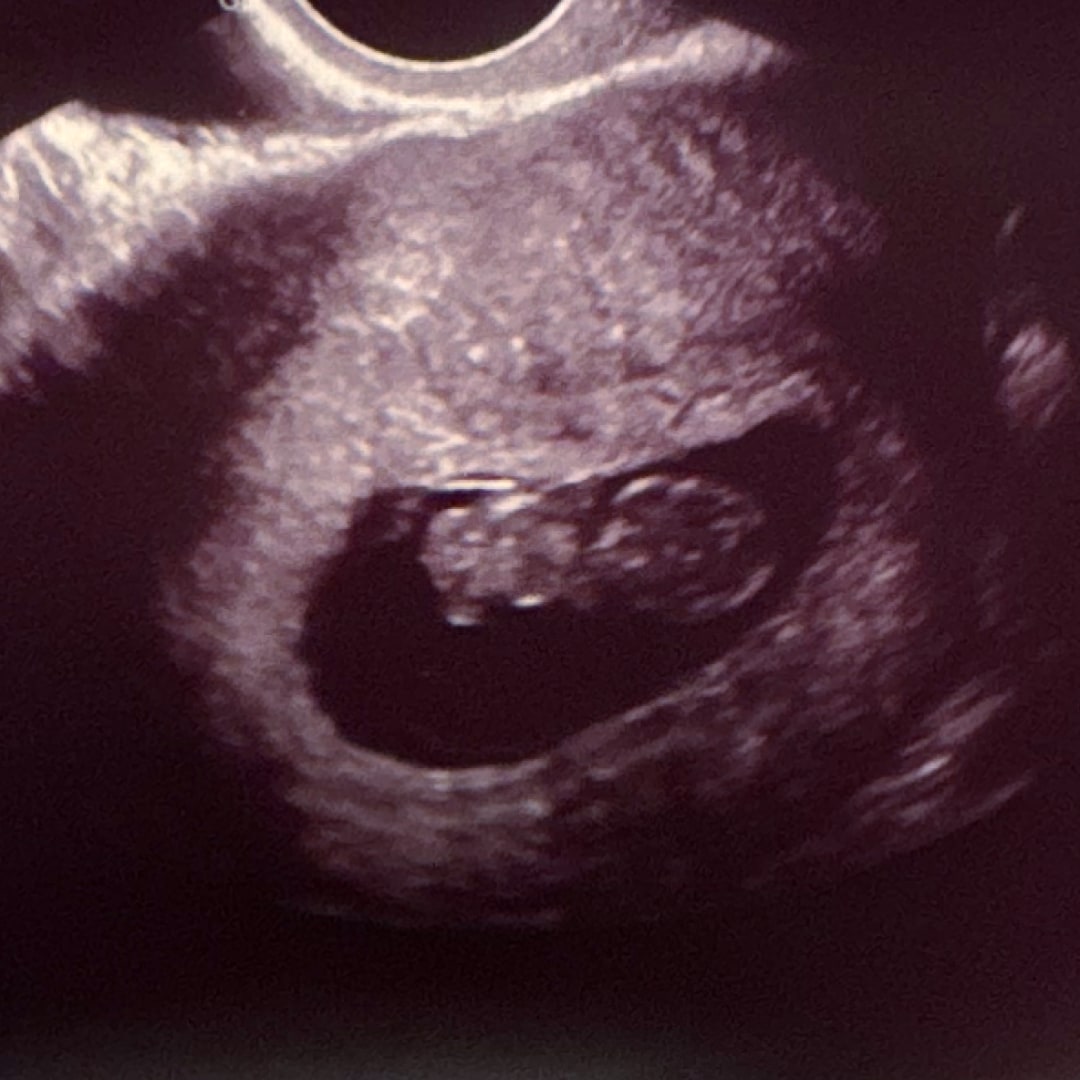 Photo shared by Olivia for their Babylist baby registry.