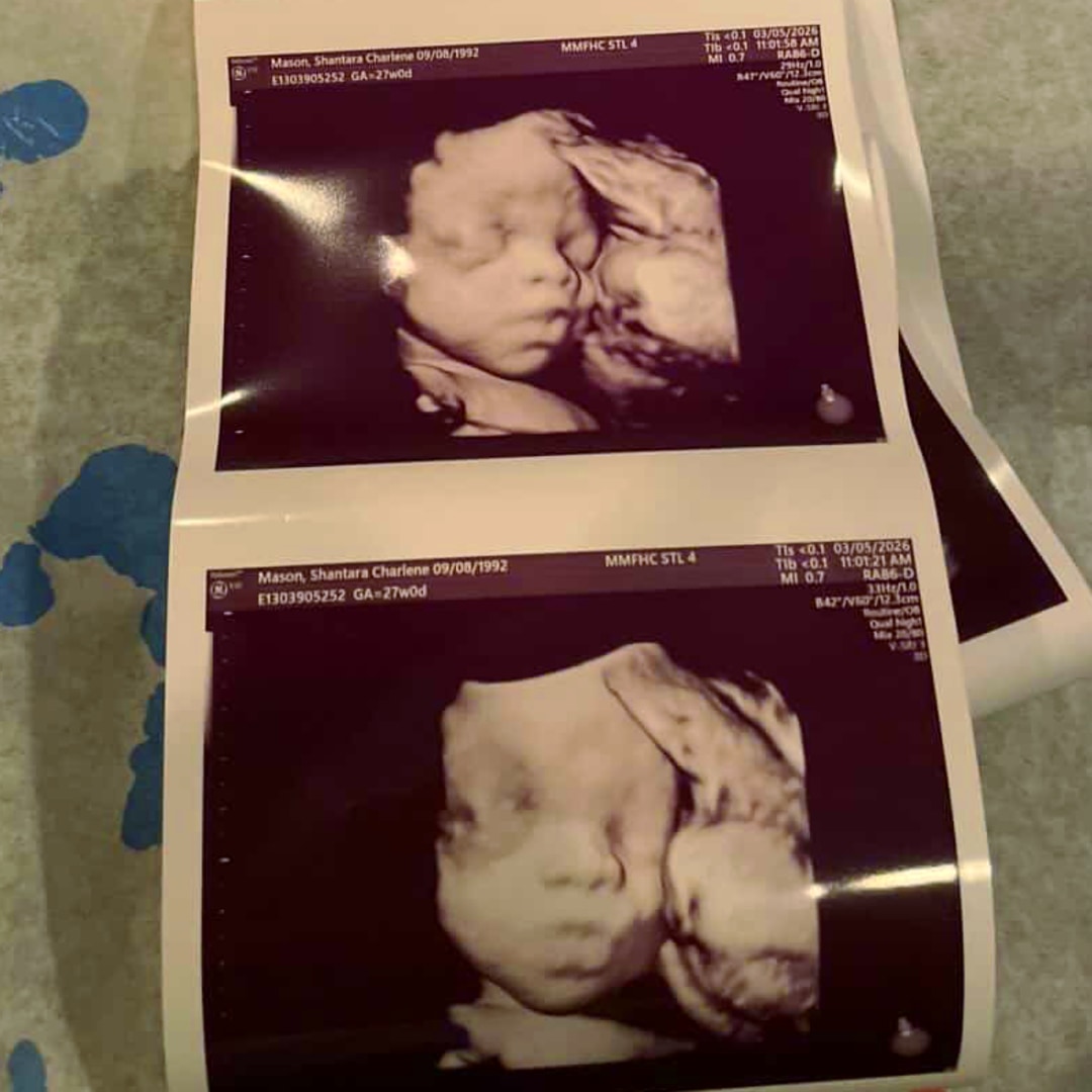 Photo shared by Shantara for their Babylist baby registry.