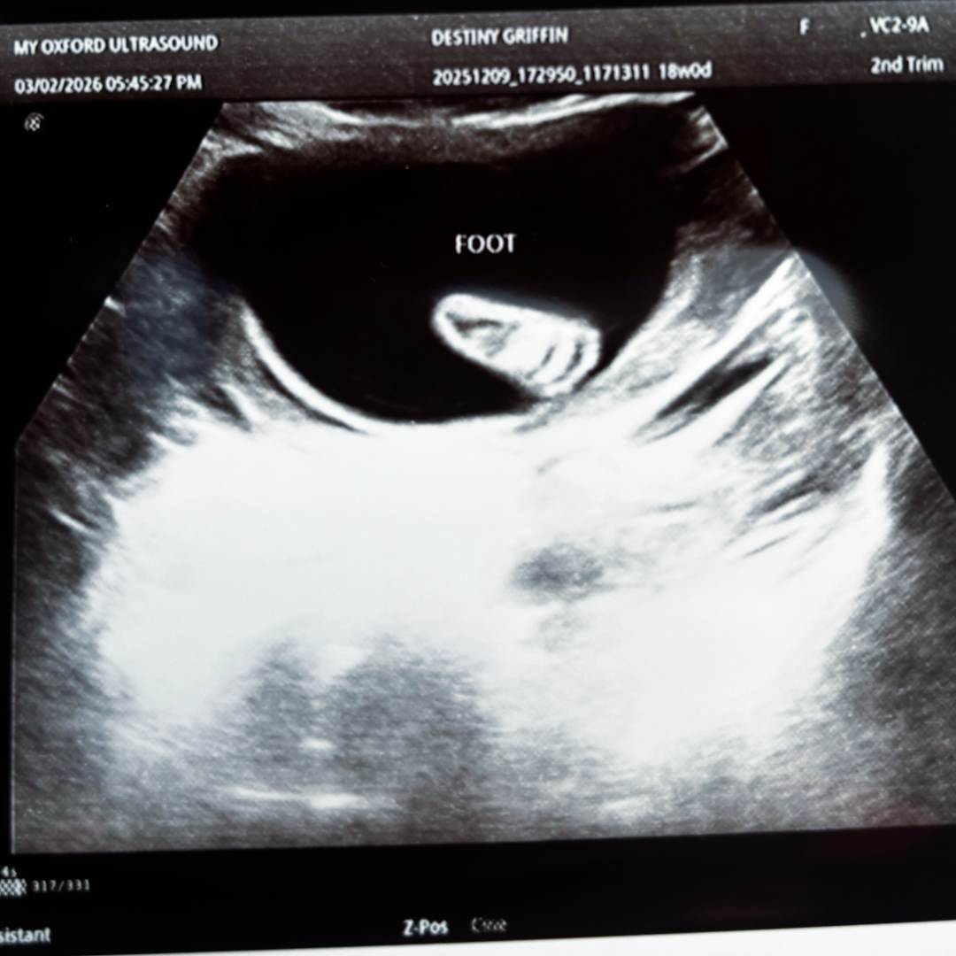 Photo shared by Destiny for their Babylist baby registry.