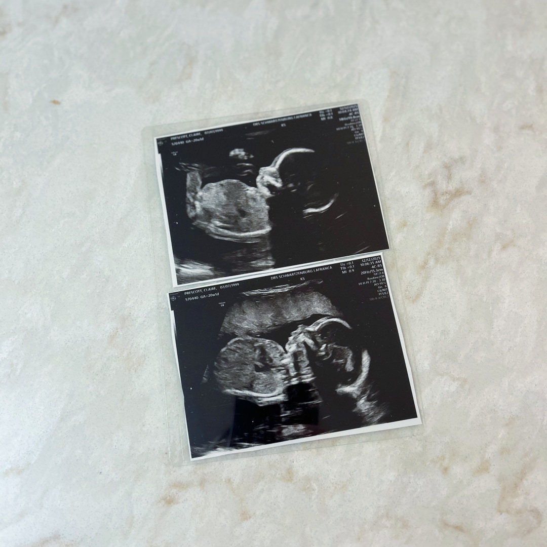 Photo shared by Claire for their Babylist baby registry.