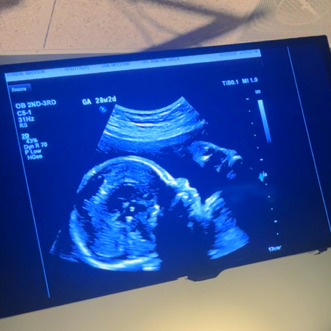 Photo shared by Madison for their Babylist baby registry.