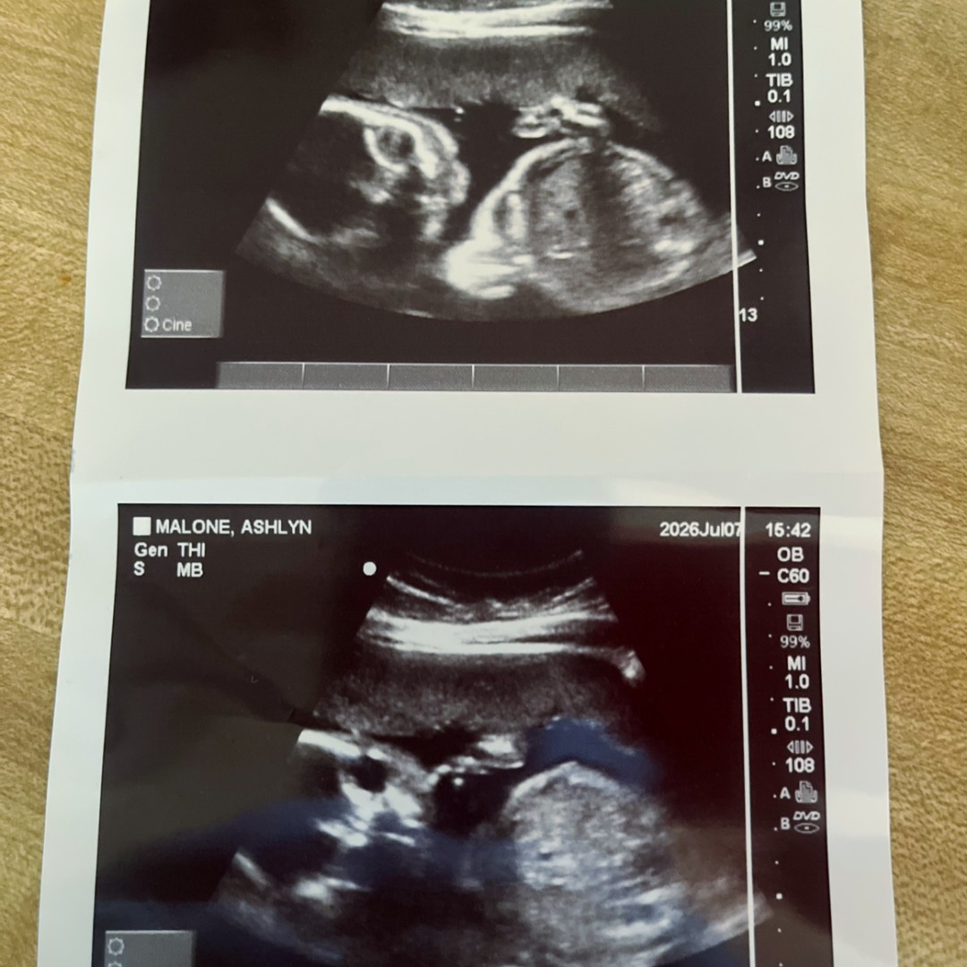 Photo shared by Ashlyn for their Babylist baby registry.