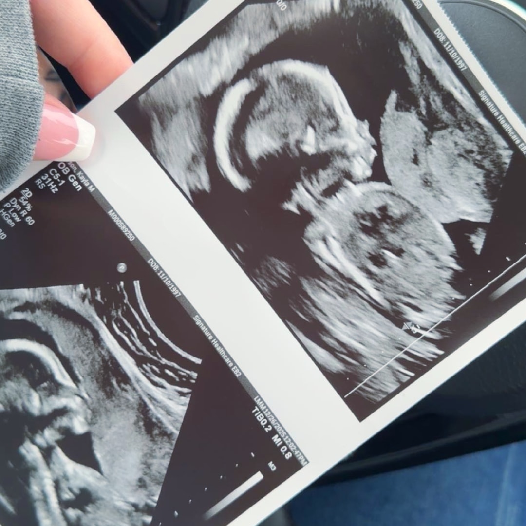 Photo shared by Kayla for their Babylist baby registry.