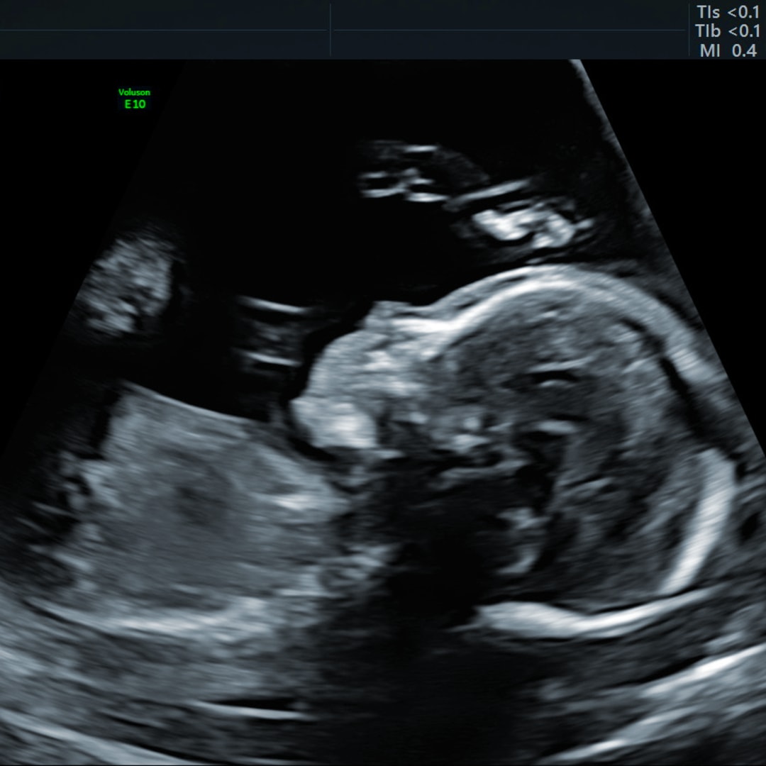 Photo shared by Catherine for their Babylist baby registry.