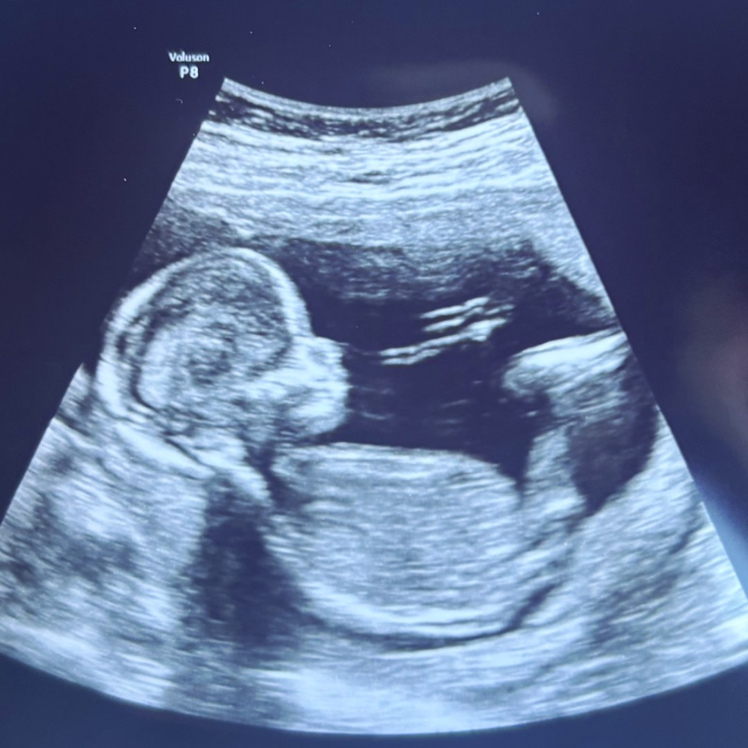Photo shared by Brooklyn for their Babylist baby registry.