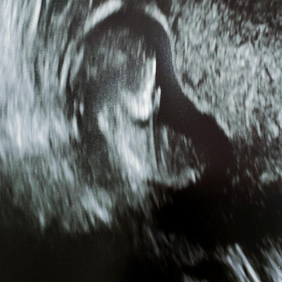 Photo shared by Tyia for their Babylist baby registry.