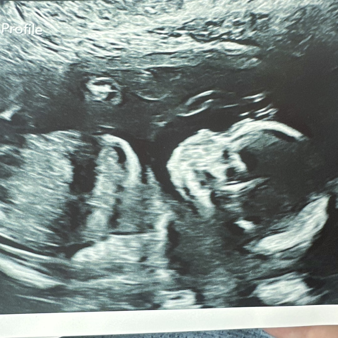 Photo shared by Bianca for their Babylist baby registry.