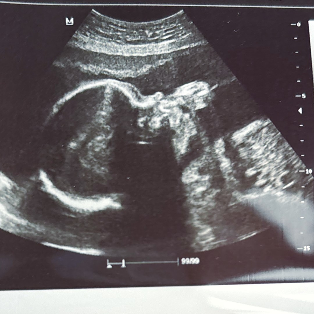 Photo shared by Kaydence for their Babylist baby registry.