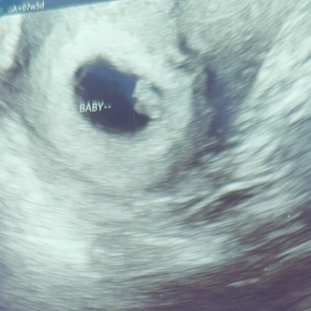 Photo shared by Allison for their Babylist baby registry.