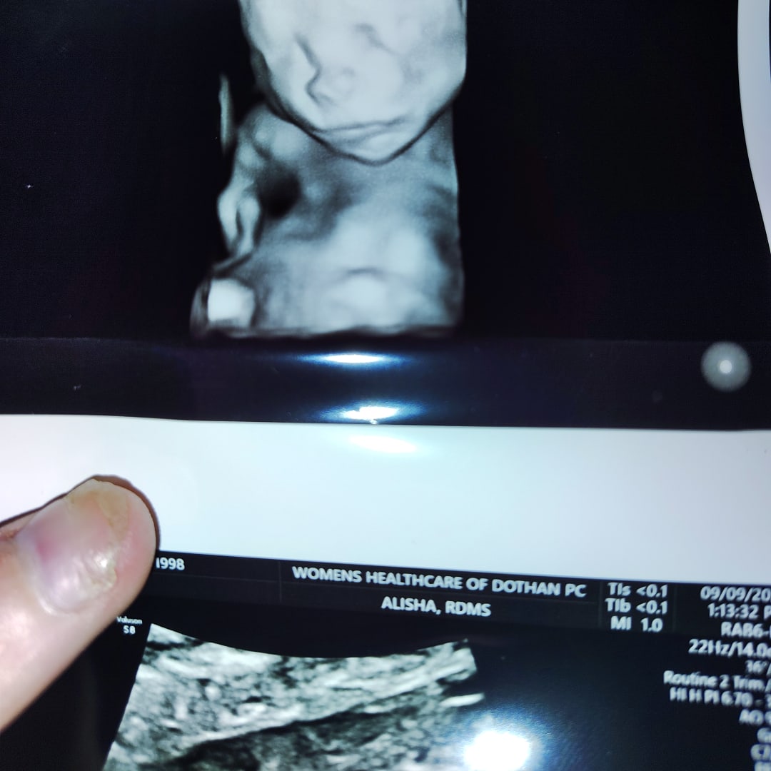 Photo shared by Rebecca for their Babylist baby registry.