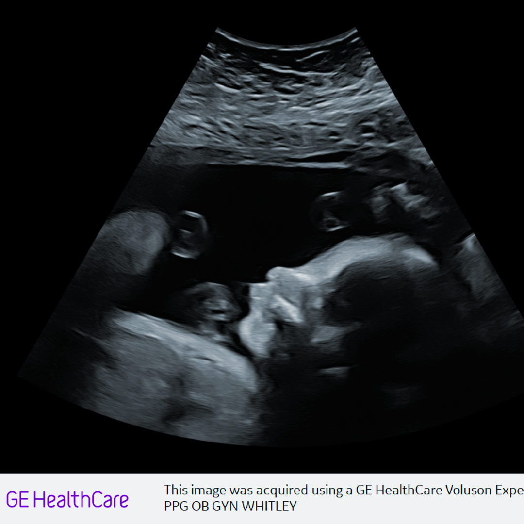 Photo shared by Katie for their Babylist baby registry.