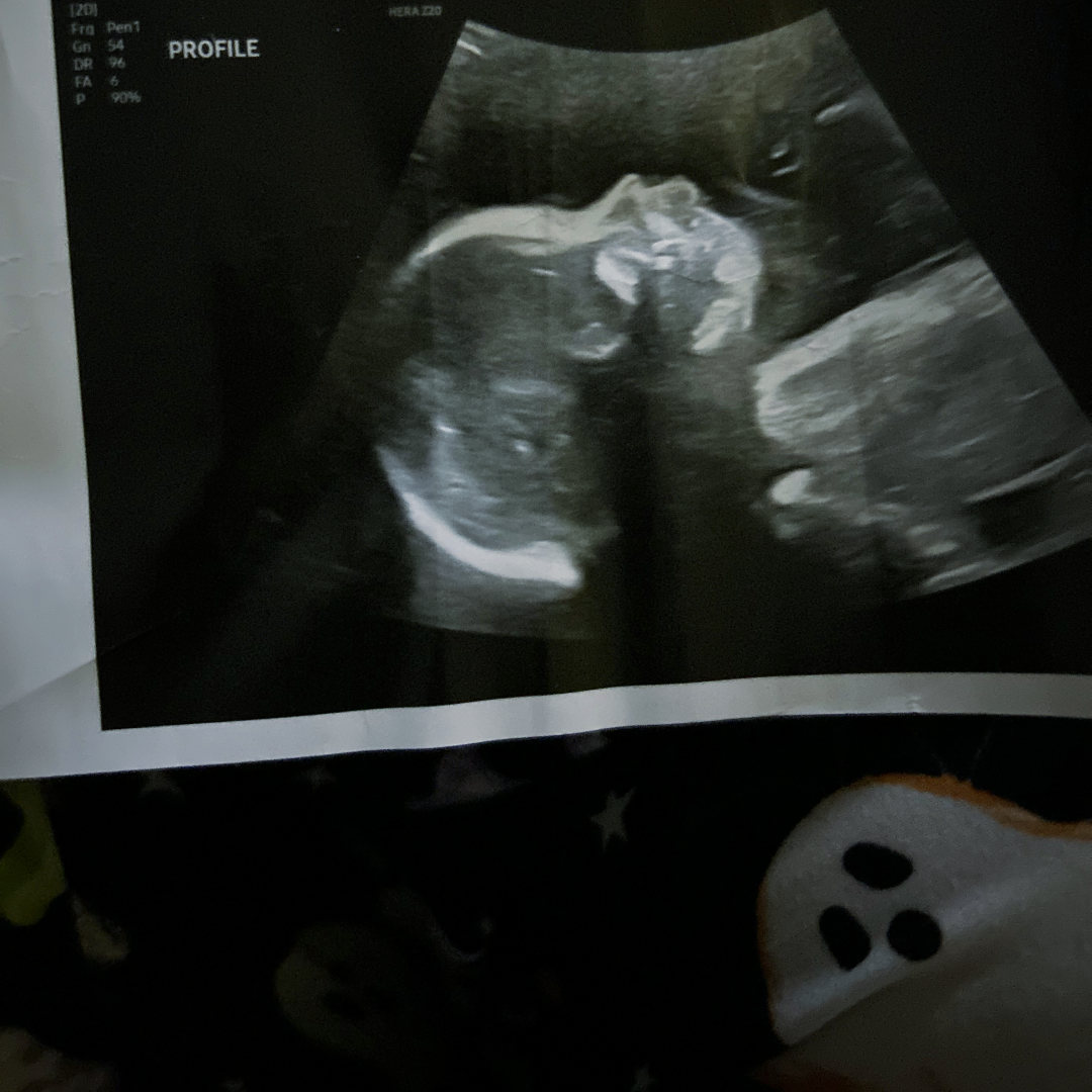 Photo shared by Karlie for their Babylist baby registry.