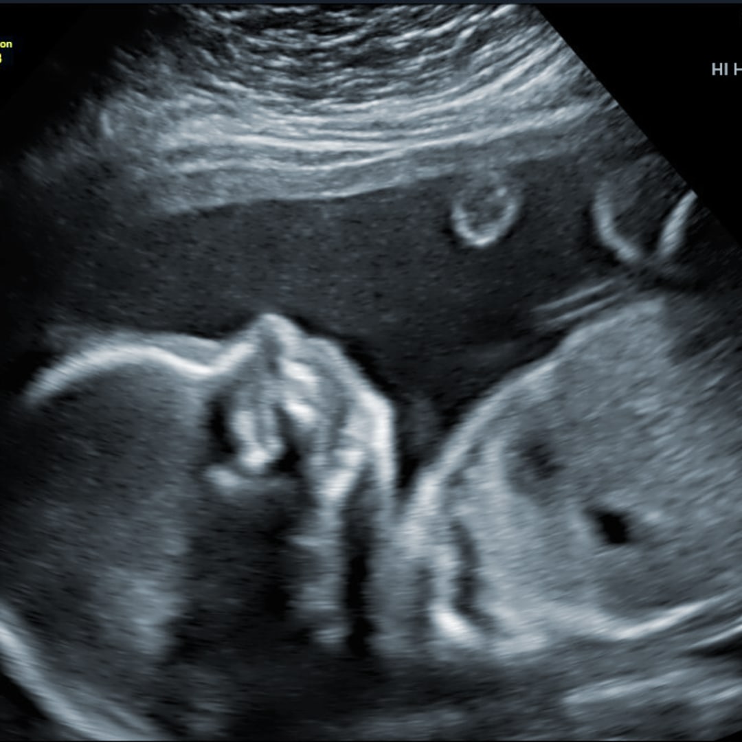 Photo shared by Nora for their Babylist baby registry.
