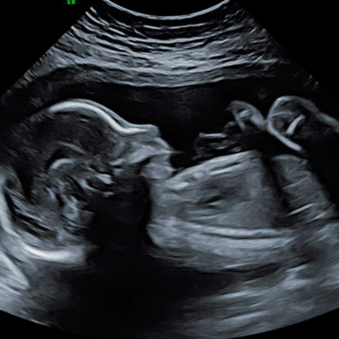 Photo shared by Ceanna for their Babylist baby registry.