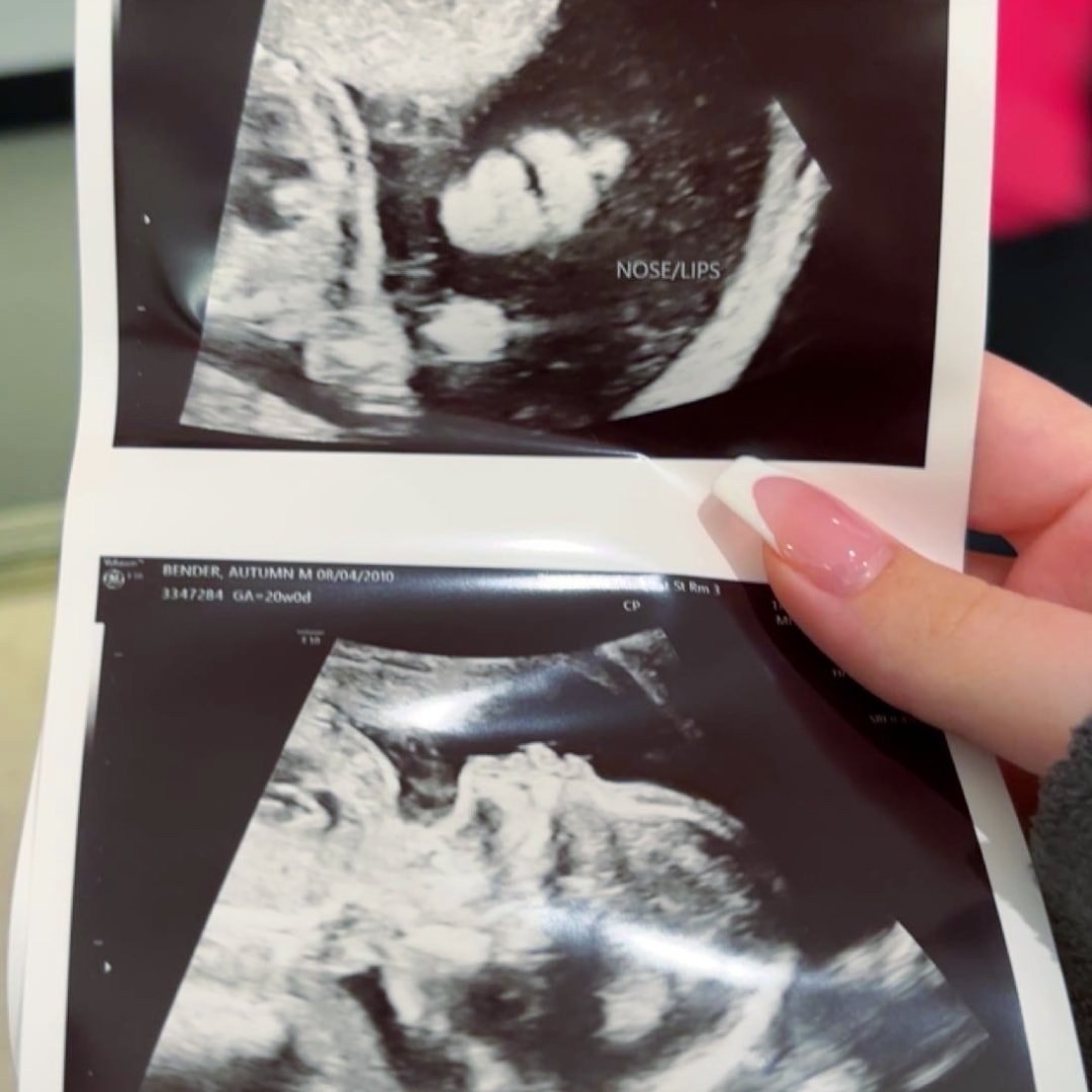 Photo shared by Autumn for their Babylist baby registry.