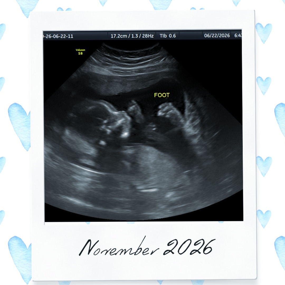 Photo shared by Victoria for their Babylist baby registry.