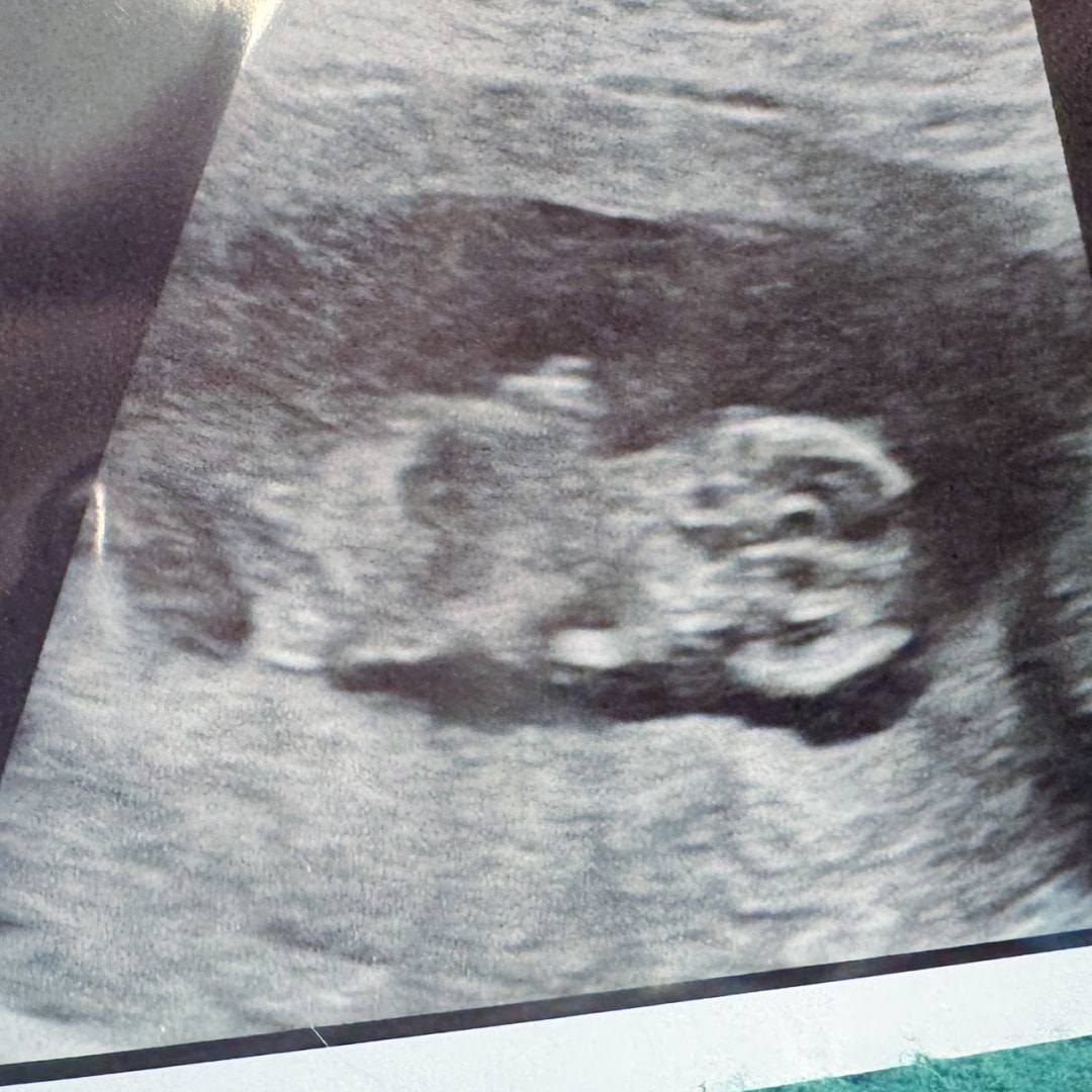 Photo shared by Caitlin for their Babylist baby registry.