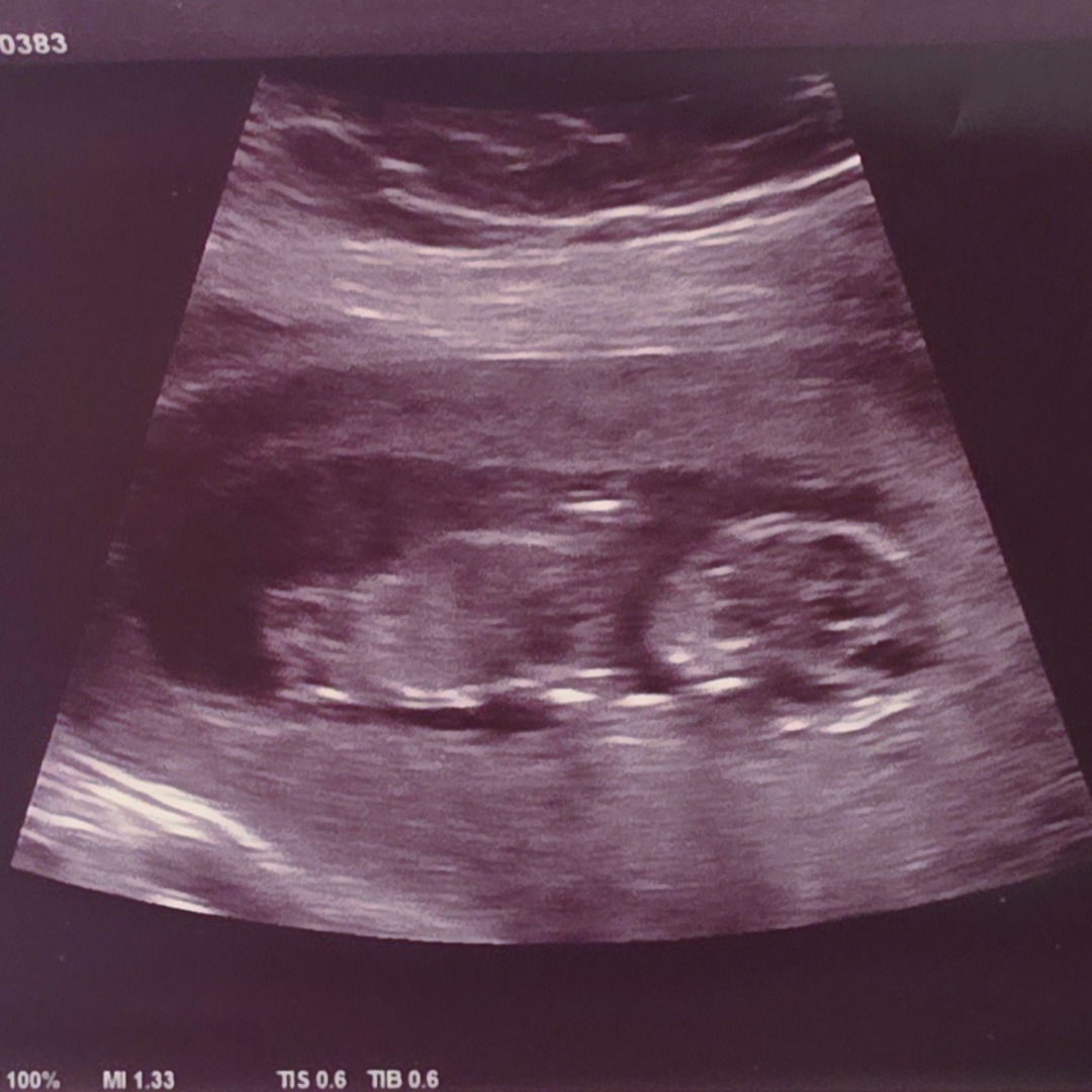 Photo shared by Emilee for their Babylist baby registry.