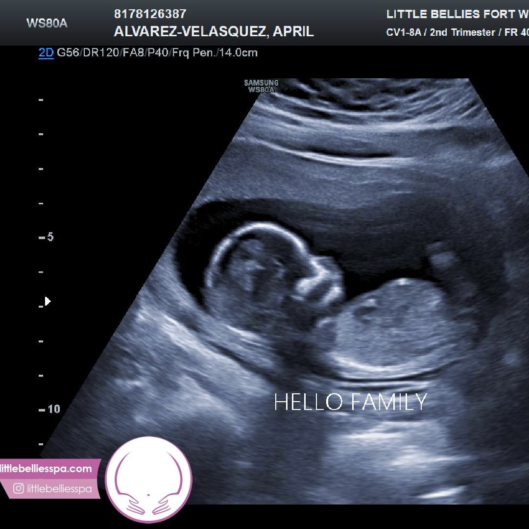 Photo shared by April for their Babylist baby registry.