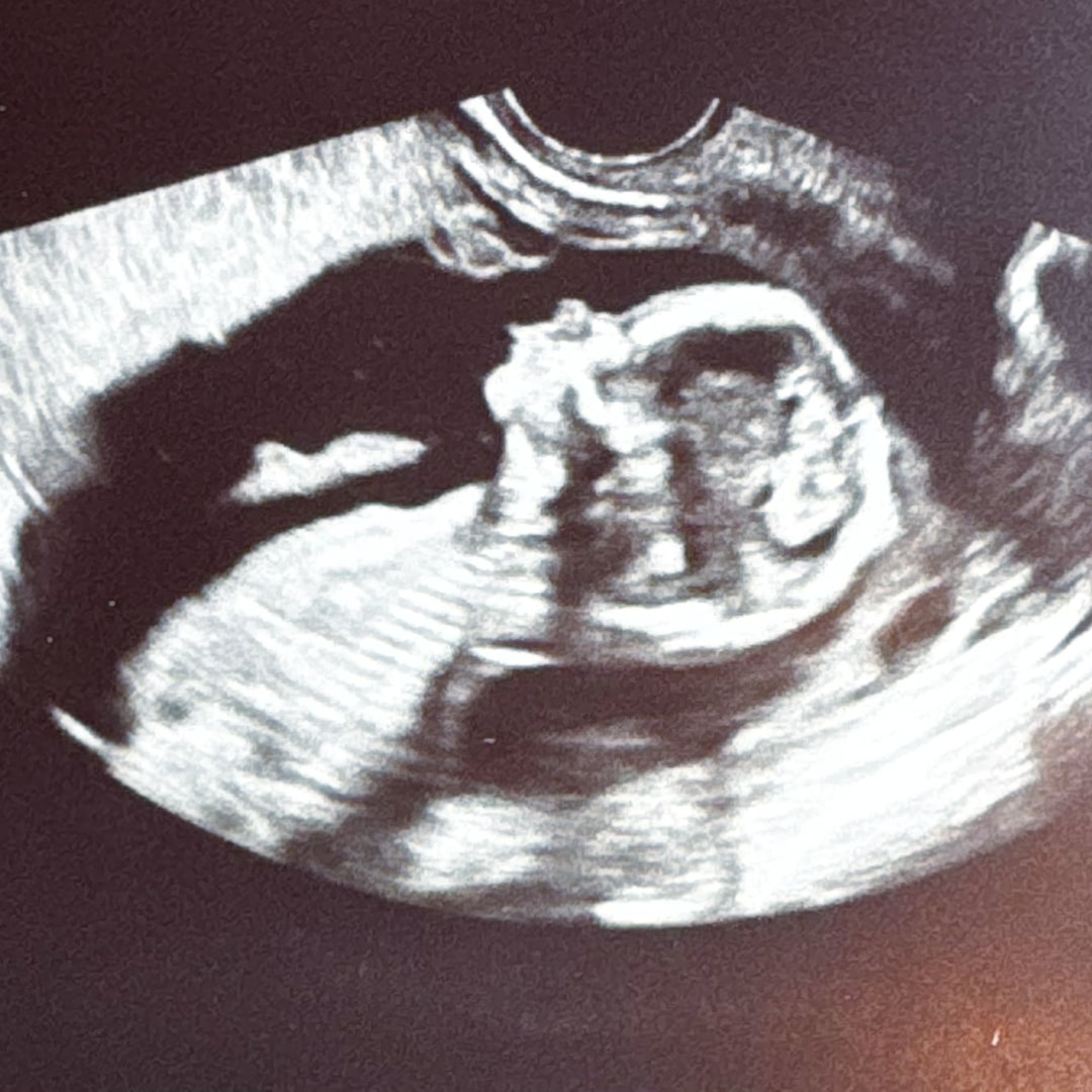 Photo shared by Jordan for their Babylist baby registry.