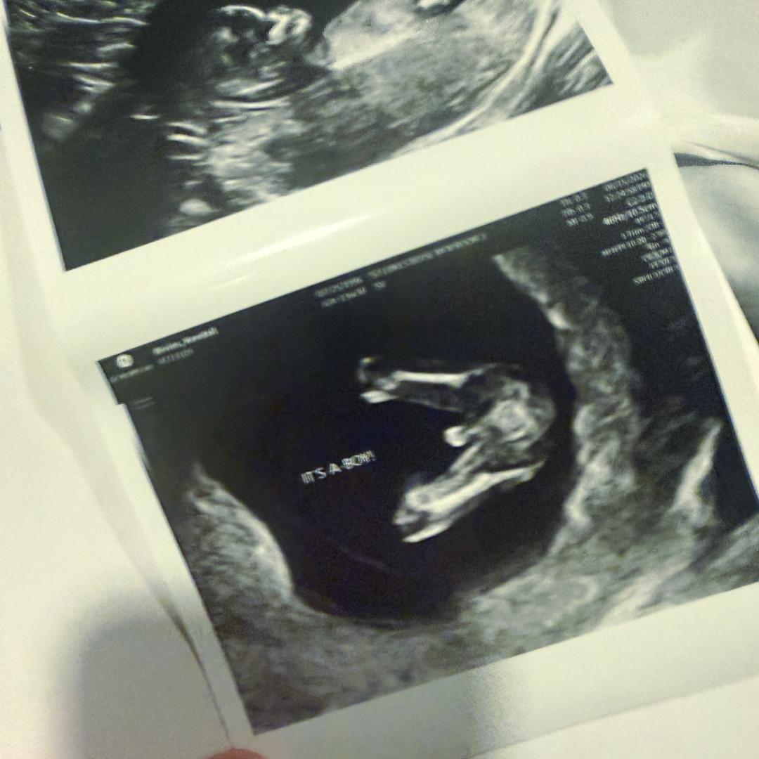 Photo shared by Kendall for their Babylist baby registry.