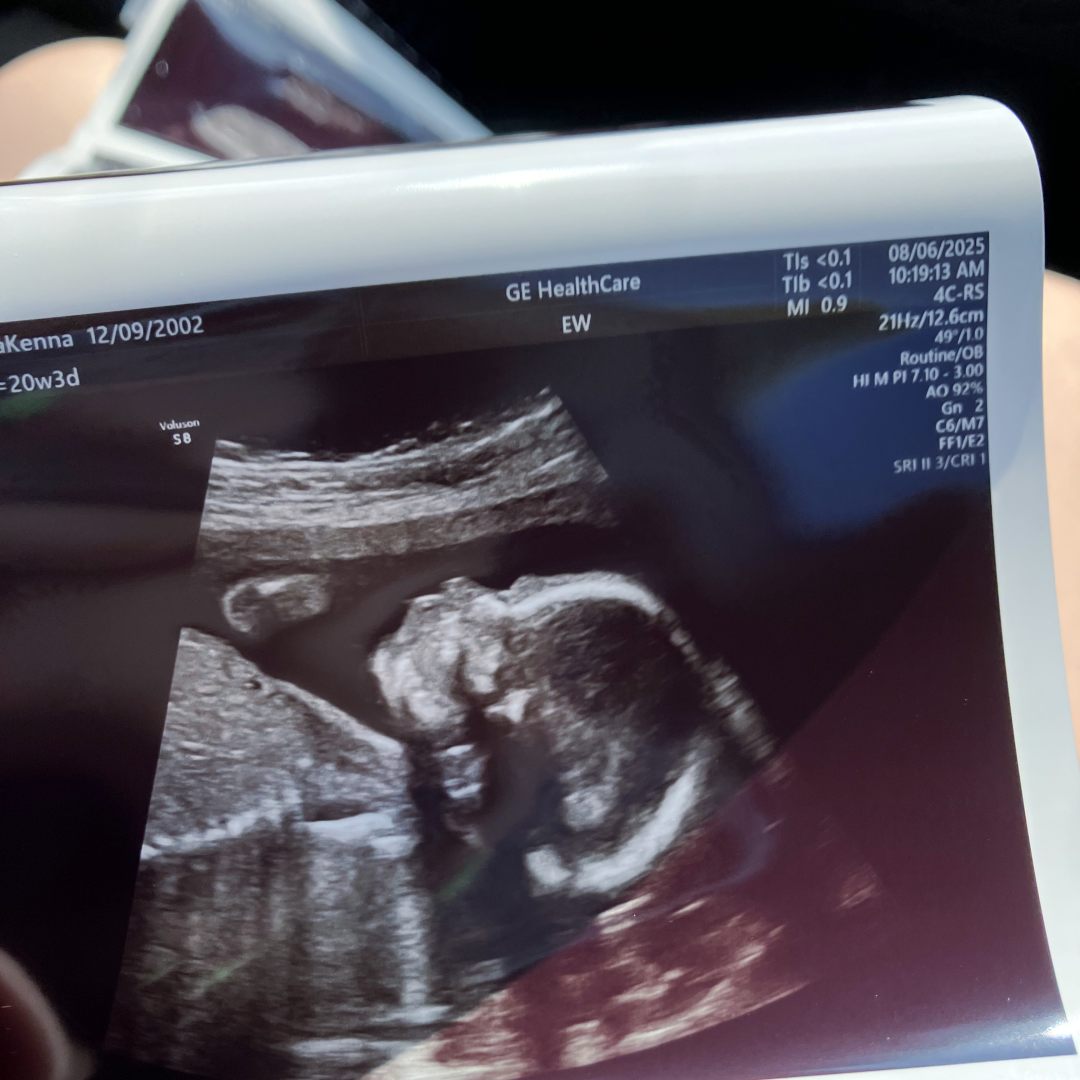 Photo shared by Makenna for their Babylist baby registry.