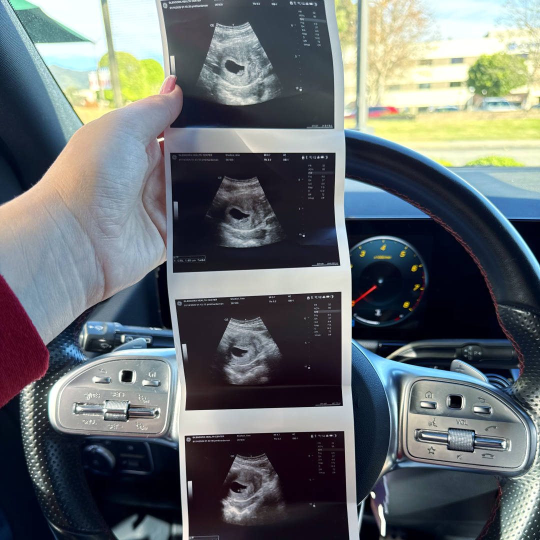 Photo shared by Ann for their Babylist baby registry.