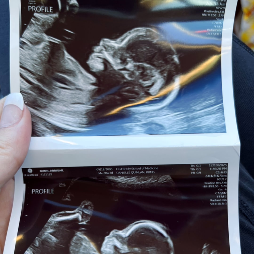 Photo shared by Abbigail for their Babylist baby registry.