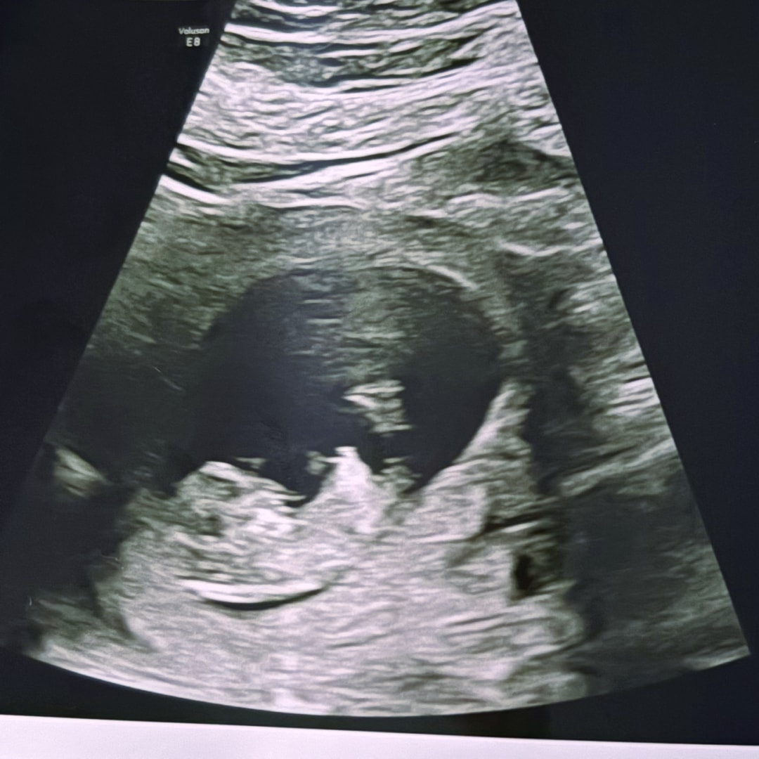 Photo shared by Bridget for their Babylist baby registry.