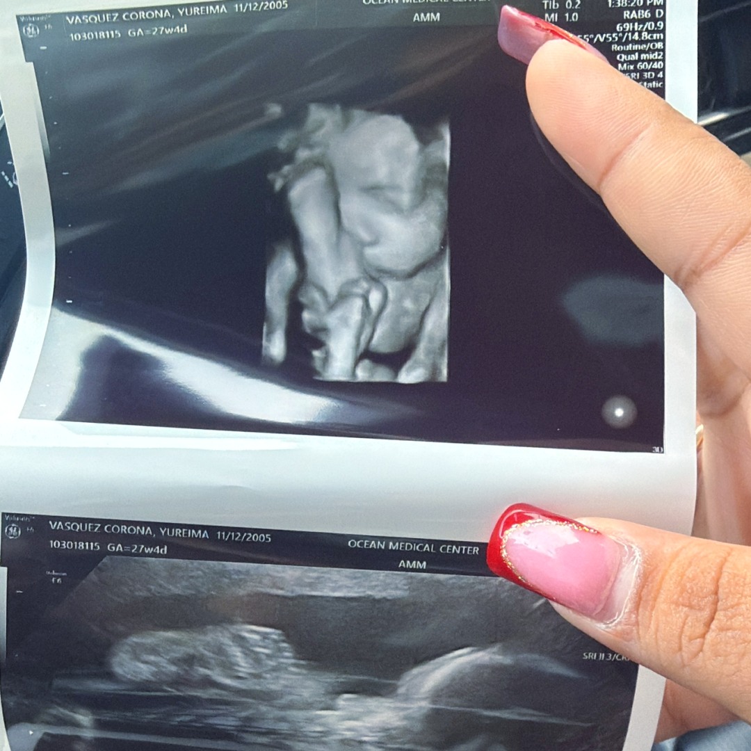 Photo shared by Yureima for their Babylist baby registry.