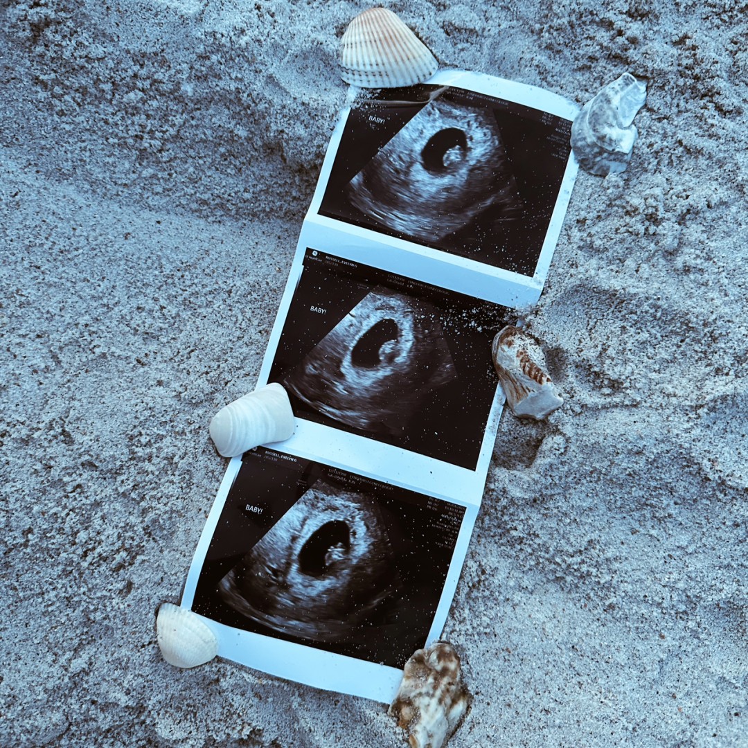 Photo shared by Evey for their Babylist baby registry.