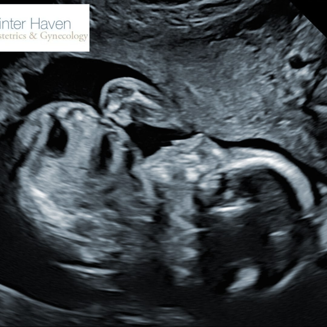 Photo shared by Shenequa for their Babylist baby registry.