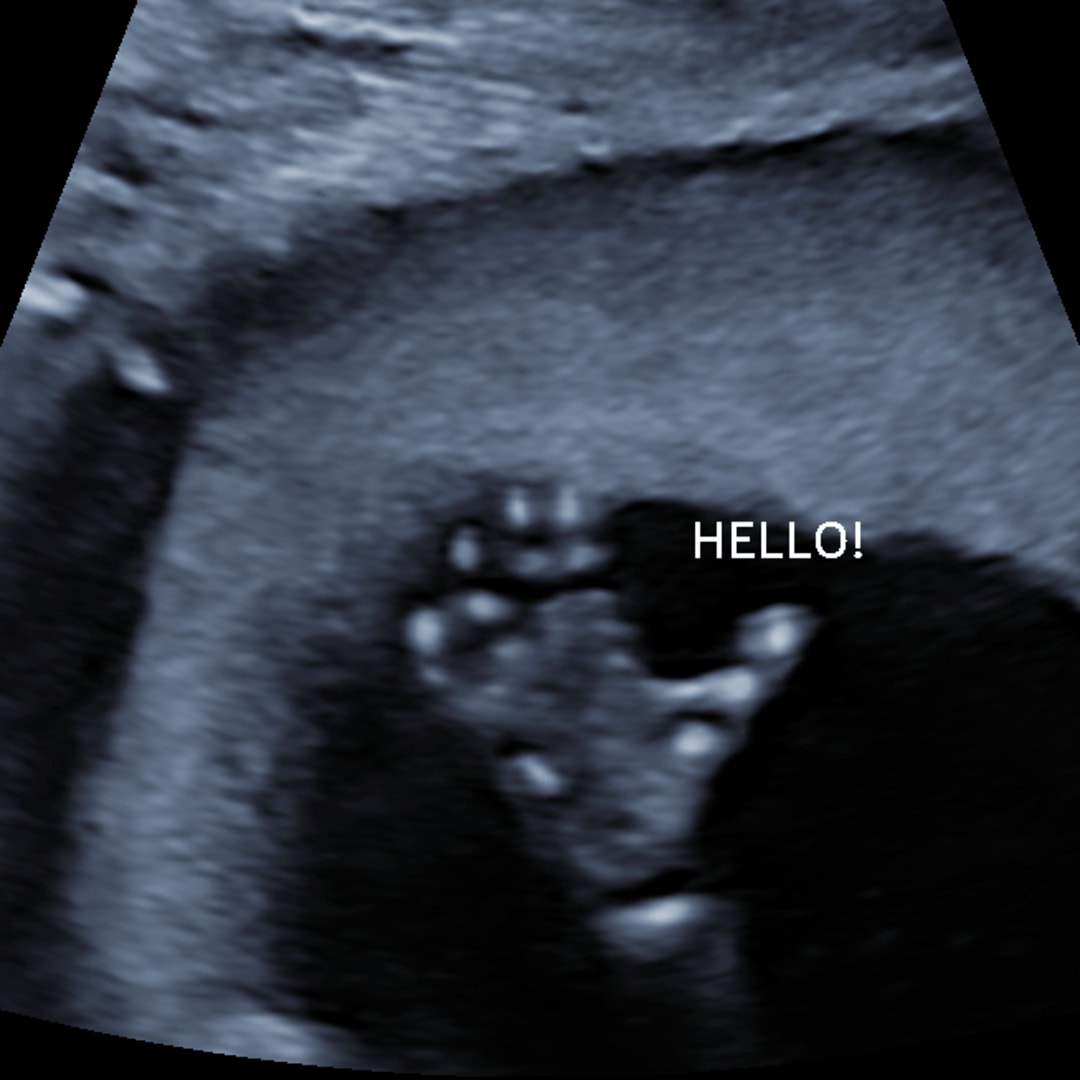 Photo shared by Jordan for their Babylist baby registry.