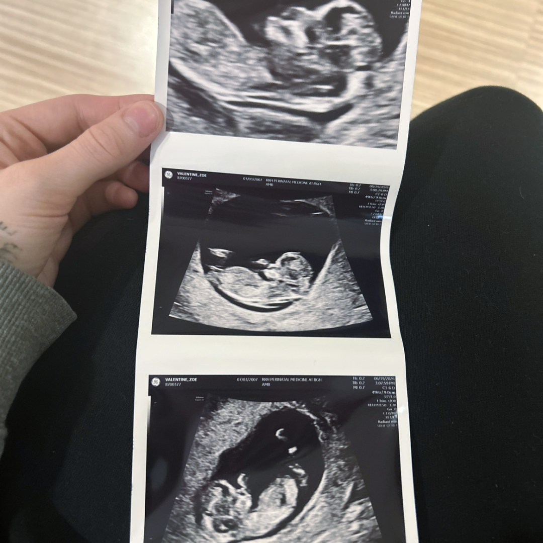 Photo shared by Zoe for their Babylist baby registry.
