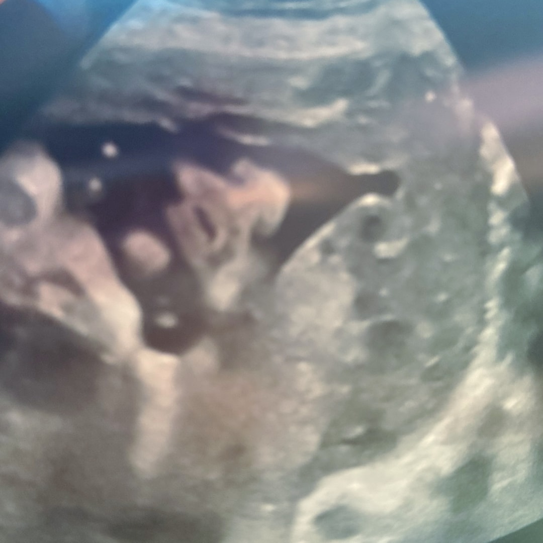 Photo shared by Karen for their Babylist baby registry.