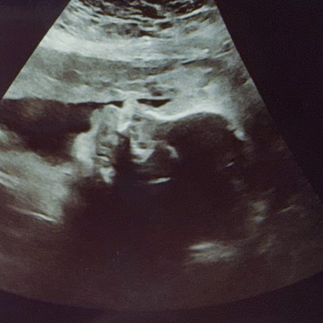 Photo shared by Elani for their Babylist baby registry.