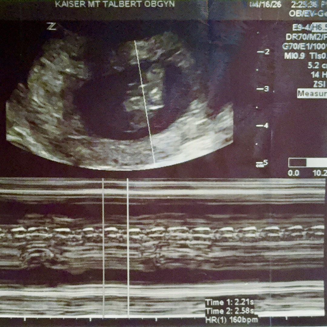 Photo shared by Kaylee for their Babylist baby registry.