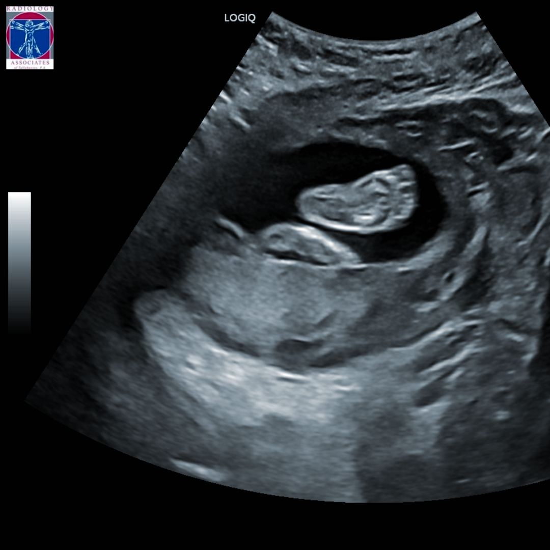 Photo shared by Aalena for their Babylist baby registry.