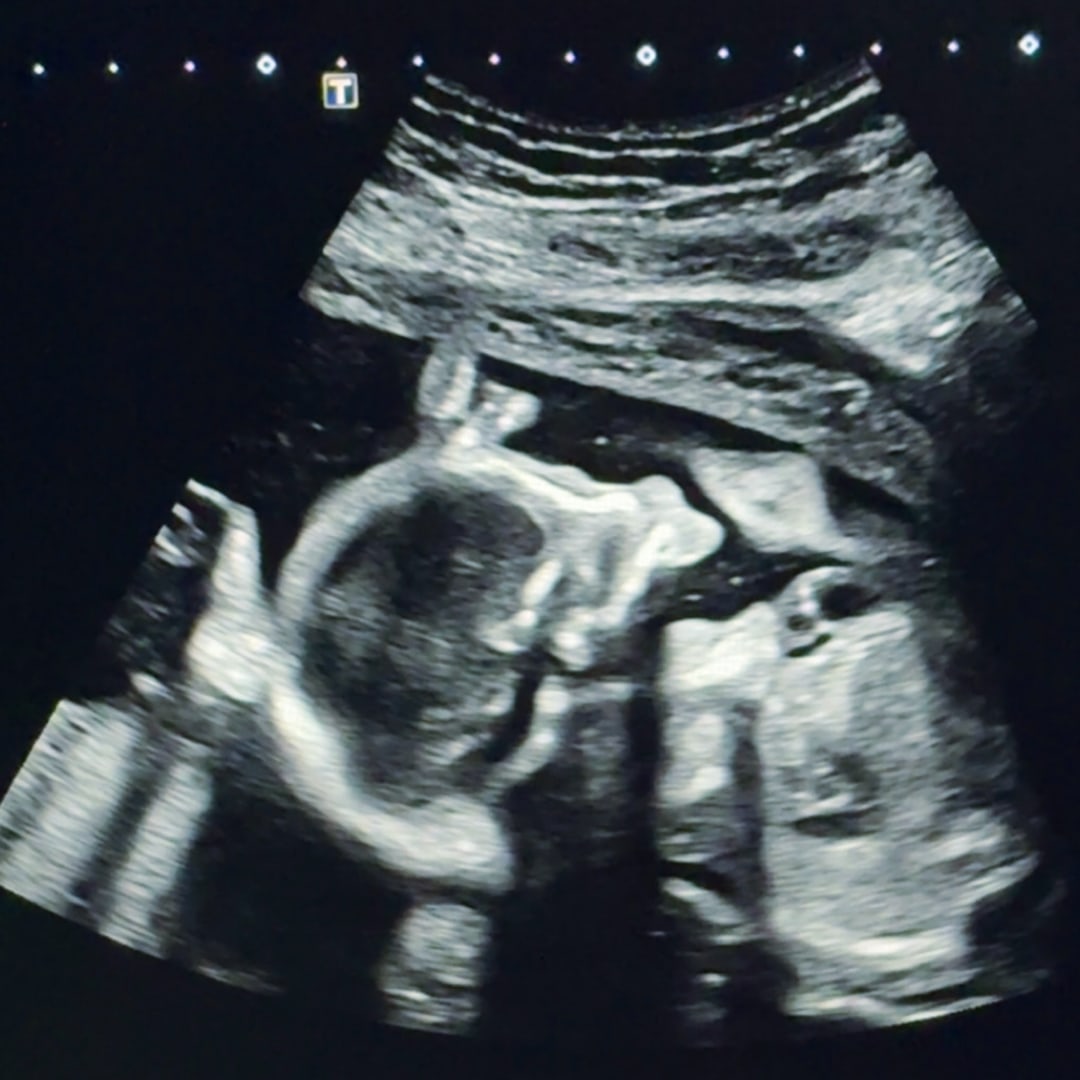 Photo shared by Cheyenne for their Babylist baby registry.